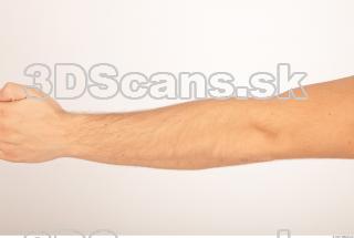 Photo reference of forearm 0001